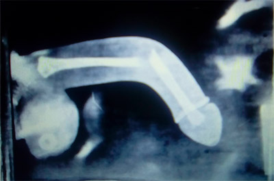 Trepadas desastrosas: casos sexuais bizarros