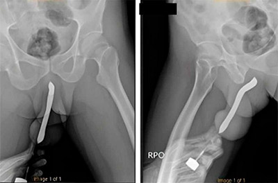 Casos bizarros pós-sexo